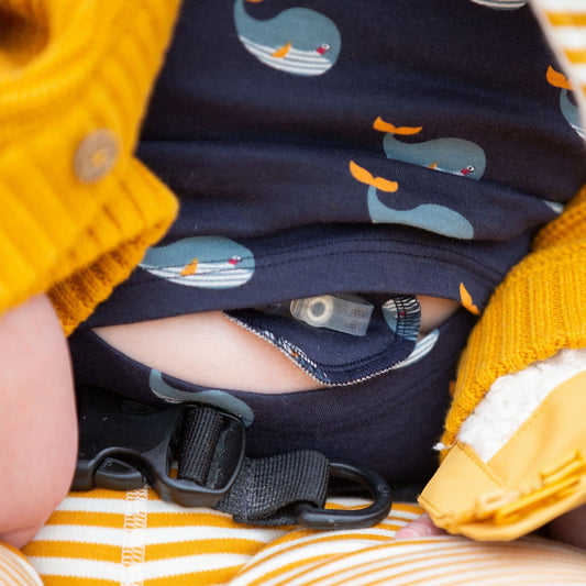 Multi Pack Adaptive Snap Closing G-Tube Pads 6 Pack